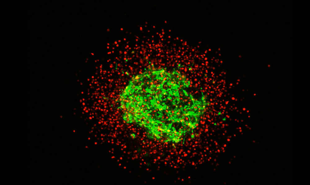 3D Cell Migration Chip (3DCM-Chip): A New Tool toward the Modeling of 3D Cellular Complex Systems